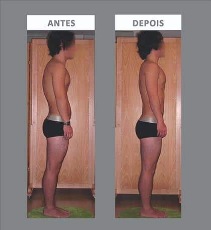 Juego de ROL para la Columna vertebral, Que es, el Ejercicio, el Antes y el Después, y Como Funciona 3