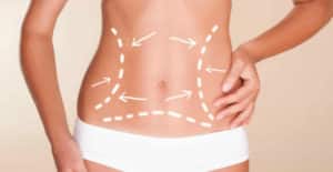 Cirugía Plástica en el Vientre – Principales Preguntas Contestadas