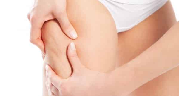 Todo Sobre la Celulitis, Tipos, Causas, Tratamientos y Consejos 1 Todo Sobre la Celulitis, Tipos, Causas, Tratamientos y Consejos 1
