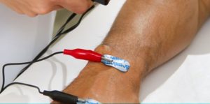 Bioimpedancia: El que es, el Examen, la Balanza y Más
