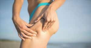 El Refrigerante Se Da La Celulitis? Y Las Estrías?