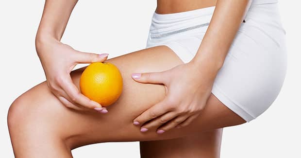 La Celulitis Tiene Cura? Tratamiento y Consejos 1 La Celulitis Tiene Cura? Tratamiento y Consejos 1