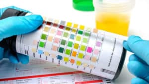 Cetoacidosis Diabética – ¿Qué es, Síntomas, Causas y Tratamiento