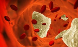 Diferencias Entre el Colesterol LDL y HDL
