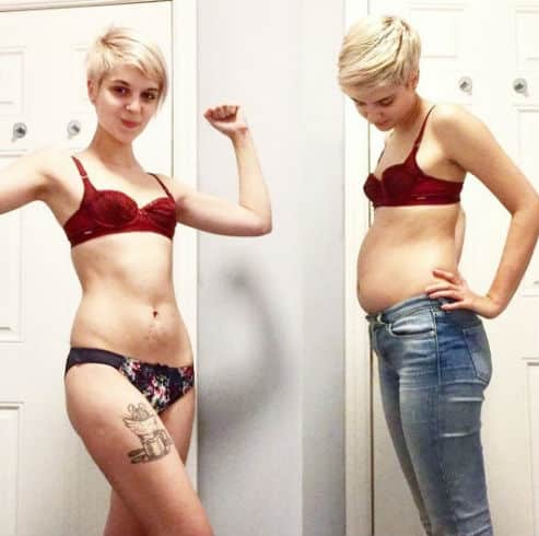 Joven Supera la Anorexia y la Muestra de Transformación para Ayudar a Otras Personas 3