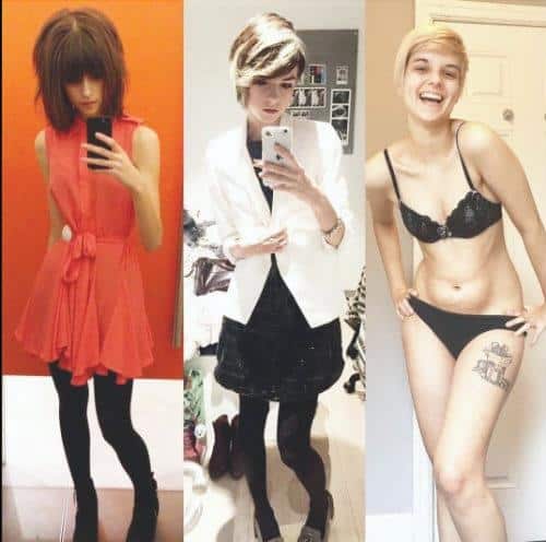 Joven Supera la Anorexia y la Muestra de Transformación para Ayudar a Otras Personas 2