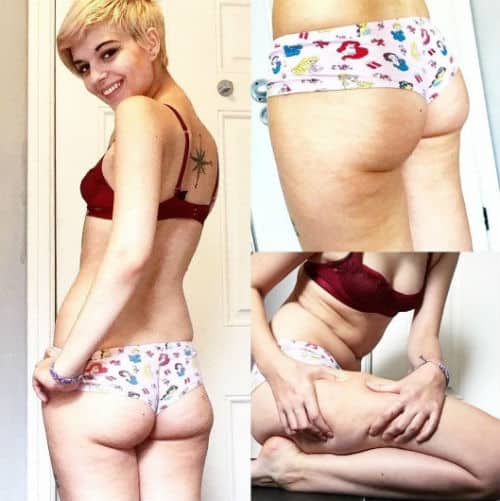 Joven Supera la Anorexia y la Muestra de Transformación para Ayudar a Otras Personas 5