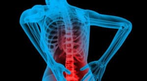 5 Remedios para el dolor en la columna más usados