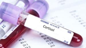 Examen de cortisol - Para que sirve y como hacer