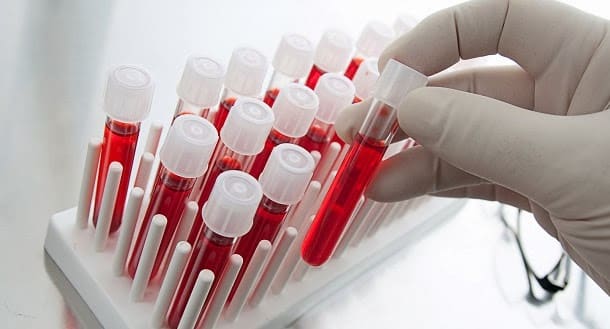 Tiroxina T4 libre, que es la función, y el examen 1 Tiroxina T4 libre, que es la función, y el examen