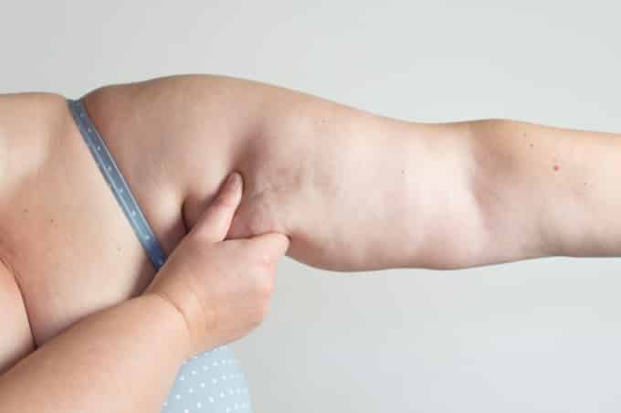 10 Consejos de Como Combatir la Flacidez 1 10 Consejos de Como Combatir la Flacidez 1