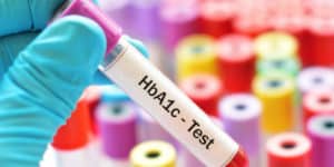 Examen de HbA1c – Lo Que es, un Resultado Normal y Valores de Referencia