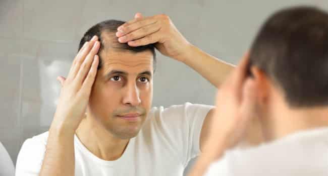 12 Remedios caseros para la caída de pelo más famosos 1 12 Remedios caseros para la caída de pelo más famosos