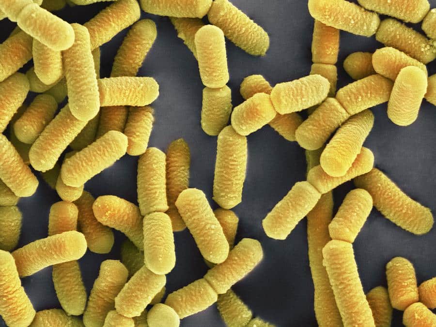 Lactobacillus Ayudan a Adelgazar? 1 Lactobacillus Ayudan a Adelgazar? 1