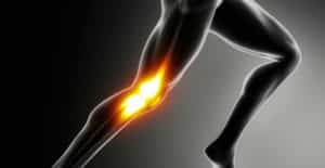 Luxación de la Rodilla – ¿ Qué es y Cómo Tratar los Síntomas, por Lo Que se