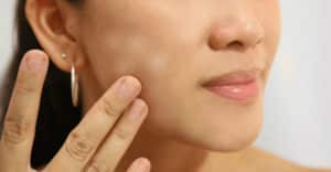Como Sacar Manchas de la Cara – Crema, Productos, Receta Casera y Cuidado