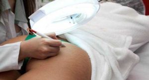 Como es el Maquillaje permanente Para las Estrías
