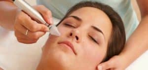 El peeling de cristal, que es el antes y el después, Para que sirve y por los consejos