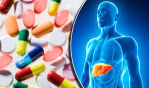 18 Remedios para el hígado más usados