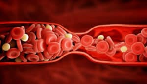Cómo afinar la sangre naturalmente - 15 consejos