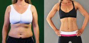 Inspírate: 15 Transformaciones de Cuerpo Increíbles