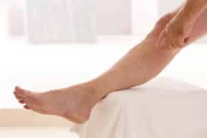 11 Consejos de Como Evitar las Varices Naturalmente