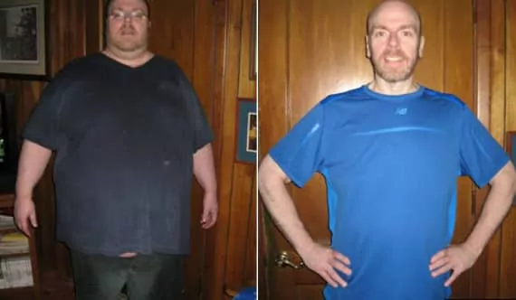 Hombre Adelgaza 135 kg Después de enterarse de que Era Demasiado Pesado para Pasar por la Cirugía Cardiaca