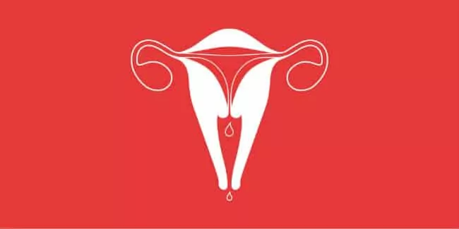 El flujo Menstrual Intenso – Que Puede Ser y Como Disminuir